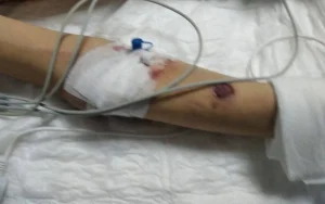 autistic-teen-dies-in-istanbul-care-home,-family-alleges-negligence