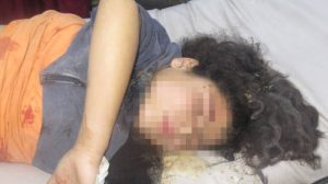 13-year-old-girl-dies-from-injuries-after-attack-by-turkish-and-jihadist-forces-in-shehba