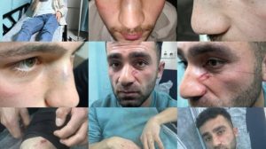 turkish-police-torture-4-young-people-in-hakkari