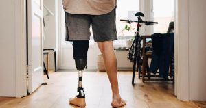 insurers-limit-coverage-of-prosthetic-limbs,-questioning-their-medical-necessity