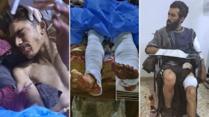 turkish-bombing-leaves-two-farmers-injured-in-gire-spi