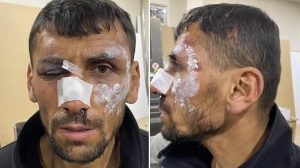 police-beat-and-detain-a-citizen-with-disability-in-van