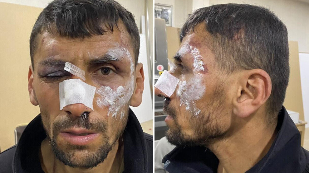 police-beat-and-detain-a-citizen-with-disability-in-van