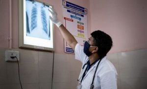 funding-cuts-jeopardise-global-fight-against-tuberculosis,-who-warns