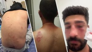 racist-attack-on-a-family-speaking-kurdish-in-mersin-leaves-one-seriously-injured