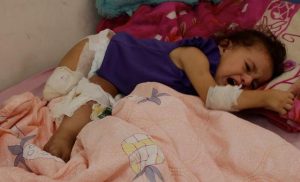 driven-by-hunger-in-gaza,-amputees-are-part-of-the-collateral-damage