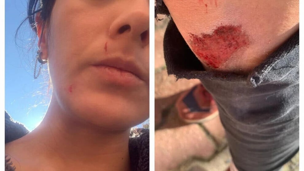 ten-people-attacked-journalist-ezgi-soysal:-they-were-going-to-kill-me-there