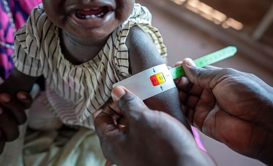 two-thirds-of-global-hunger-concentrated-in-10-conflict-hit-countries