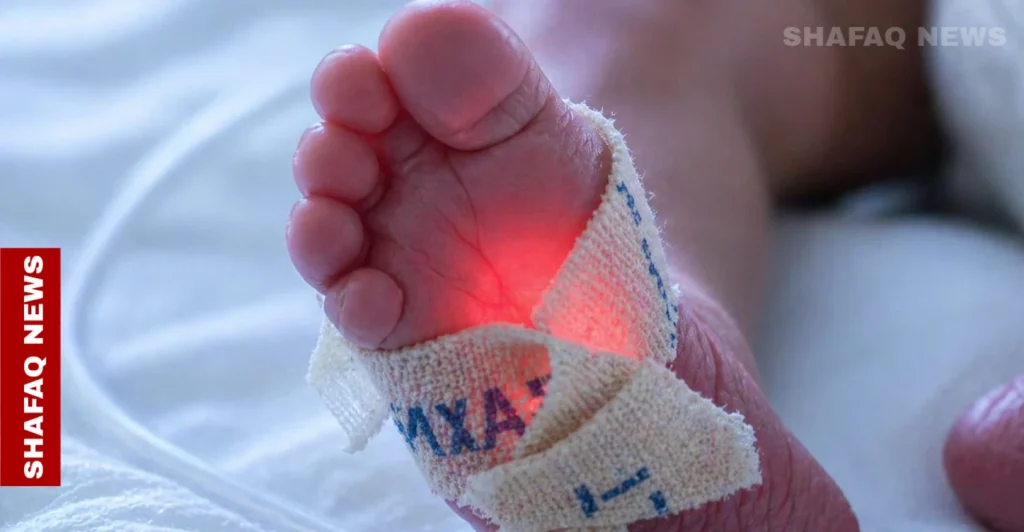 al-sulaymaniyah-hospitals-face-a-critical-shortage-of-medical-equipment-–-shafaq-news