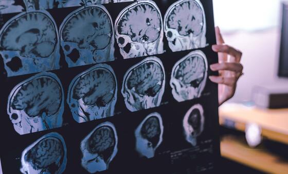 new-guidance-offers-hope-for-reducing-the-global-toll-of-dementia